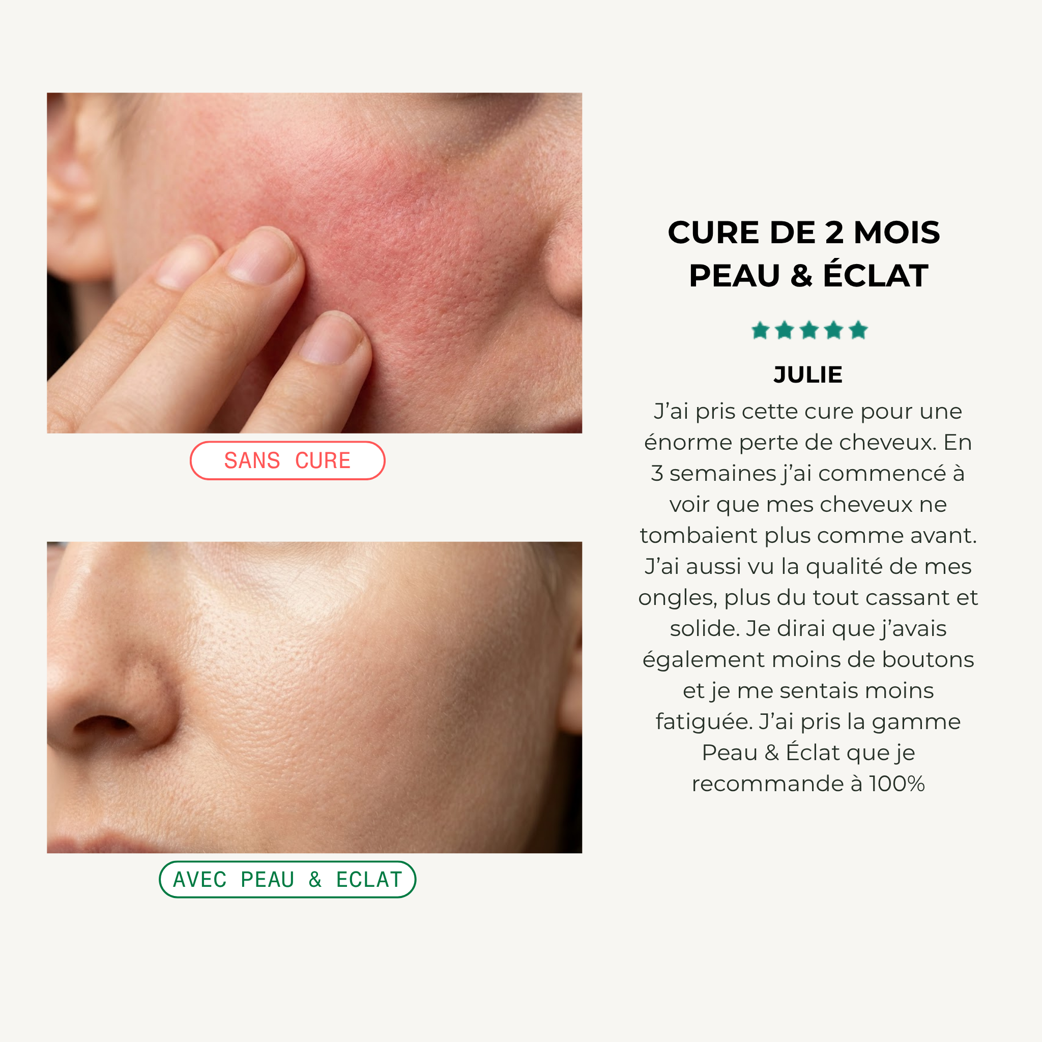 Peau & Éclat - 2 mois (60 gélules) 4